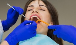 Transform Your Smile with Full Mouth Restoration in Lafayette, LA