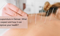 Acupuncture in Denver: What to expect and how it can improve your health?