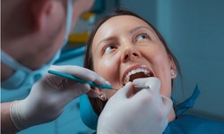 Crowning Achievements: The Ultimate Guide to Dental Crowns in Ventura