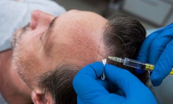 Which is The Better Hair Restoration Laser Cap, iRestore or Capillus?