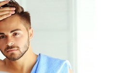 Things to Know About Before and After FUE Hair Transplant Effects