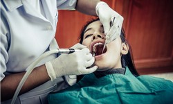 Guardians of Your Smile: Exploring the Benefits of Dental Sealants in Westport