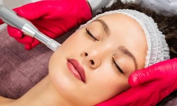 An In-Depth Analysis of Micro Needling Services at Kane Medical Aesthetics