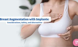 Breast Augmentation with Implants: Considerations, Safety, and Alternatives