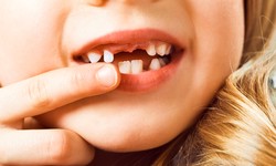 How Can I Identify Signs of Dental Problems in My Child?