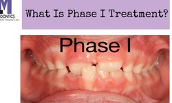 Phase 1 vs. Phase 2 Orthodontic Treatment: What's the Difference?