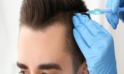 Rediscovering Confidence: The Art of Hair Transplant in Islamabad