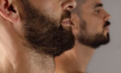 From Patchy to Perfect: The Turkey Beard Transplant Phenomenon