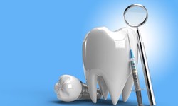 Discovering the Beauty of Dental Implants in Mount Waverley