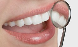 Perth's Perfect Smile: Cosmetic Dentistry & All-on-4 Implants