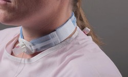 Linking Confidence: Tracheostomy Tube Holders in Focus
