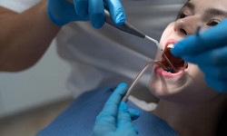 Discovering Excellence: Implant Dentist Services in Lake Mary