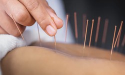 Discovering Harmony: Chinese Acupuncture & Chinese Medicine Clinics