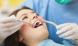 Understanding Wisdom Tooth Extraction Cost in Singapore
