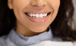 SMILE CONFIDENTLY WITH TOOTH IMPLANTS SCARBOROUGH