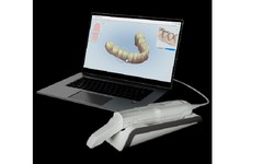 The Transformative Impact of Dental Scanners in Modern Dentistry