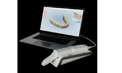 Choosing an Intraoral Scanner for Your Dental Practice