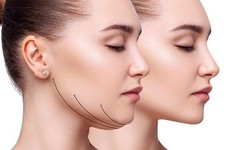 Eliminating Double Chin Woes: Effective Solutions in Islamabad