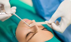 The Role of Experience in Septoplasty Surgery Choosing a Skilled Surgeon
