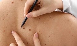 Unlock Your Skin's Potential: Dubai's Lesion Removal Specialists