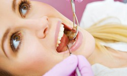 How to Ensure a Smooth Recovery After Molar Root Canal Treatment
