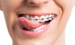Exploring Orthodontics: The Expertise of Orthodontists