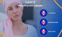 Unraveling the Enigma: Understanding Parathyroid Cancer with ACTC Health