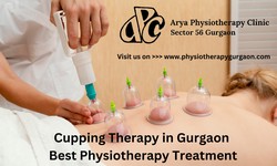 Beyond the Hype: Exploring the Realities of Cupping Therapy