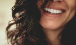 The Psychological Benefits of Straight Teeth and How to Achieve Them