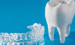 What is braces invisalign? Are they right for me?