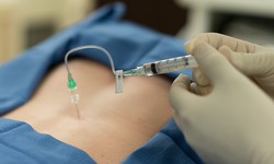 Epidural Steroid Injections for Pain Likely Have Limited Efficacy Among Older Adults