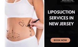 Liposuction Services in New Jersey - Aesthetiq Plastic Surgery Priti P Patel MD