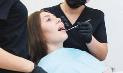 When Should You Consider Dental Implants Over Other Options?