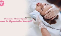 What are the Different Types of Lasers for Pigmentation Removal?