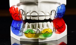 Maximize Efficiency: Your Go-To China Outsourcing Dental Lab