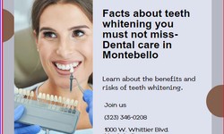 Facts about teeth whitening you must not miss- Dental care in Montebello