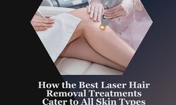 How the Best Laser Hair Removal Treatments Cater to All Skin Types- Aesthetiq Plastic Surgery Priti P Patel MD