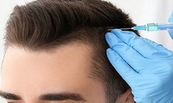 Tress Triumph: Navigating the Path to Hair Restoration with a Hair Transplant in Islamabad