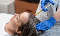 Microneedling Mastery: A Guide to the Best Tools for Hair Loss Treatment