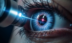 About Keratoconus Treatment And Its Various Aspects