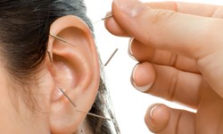 Revitalize Yourself with Auricular Acupuncture Treatment at West Island Clinic