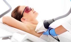 Unveiling the Science and Benefits of Laser Hair Removal in Islamabad