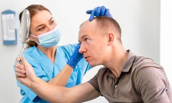Hair Transplant Surgery in Andheri: A Comprehensive Guide