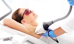 The Ultimate Guide to Laser Hair Removal in Islamabad: Everything You Need to Know