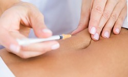 Birmingham's Beauty Breakthrough: Fat Dissolving Injections Revealed