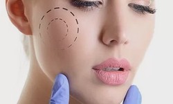 Finding the Right Surgeon for Cheek Augmentation in Dubai
