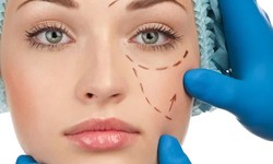 Preparing For Plastic Surgery In South Korea: A Comprehensive Guide For Informed Decision-Making