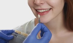 How To Take Care Of Your Porcelain Veneers?