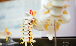 Optimizing Spine Health: Dr. Himanshu Gupta's Commitment to Excellence in Jaipur