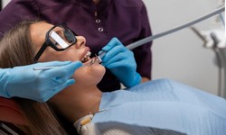 Filling in the Gaps: Understanding the Basics of Teeth Fillings